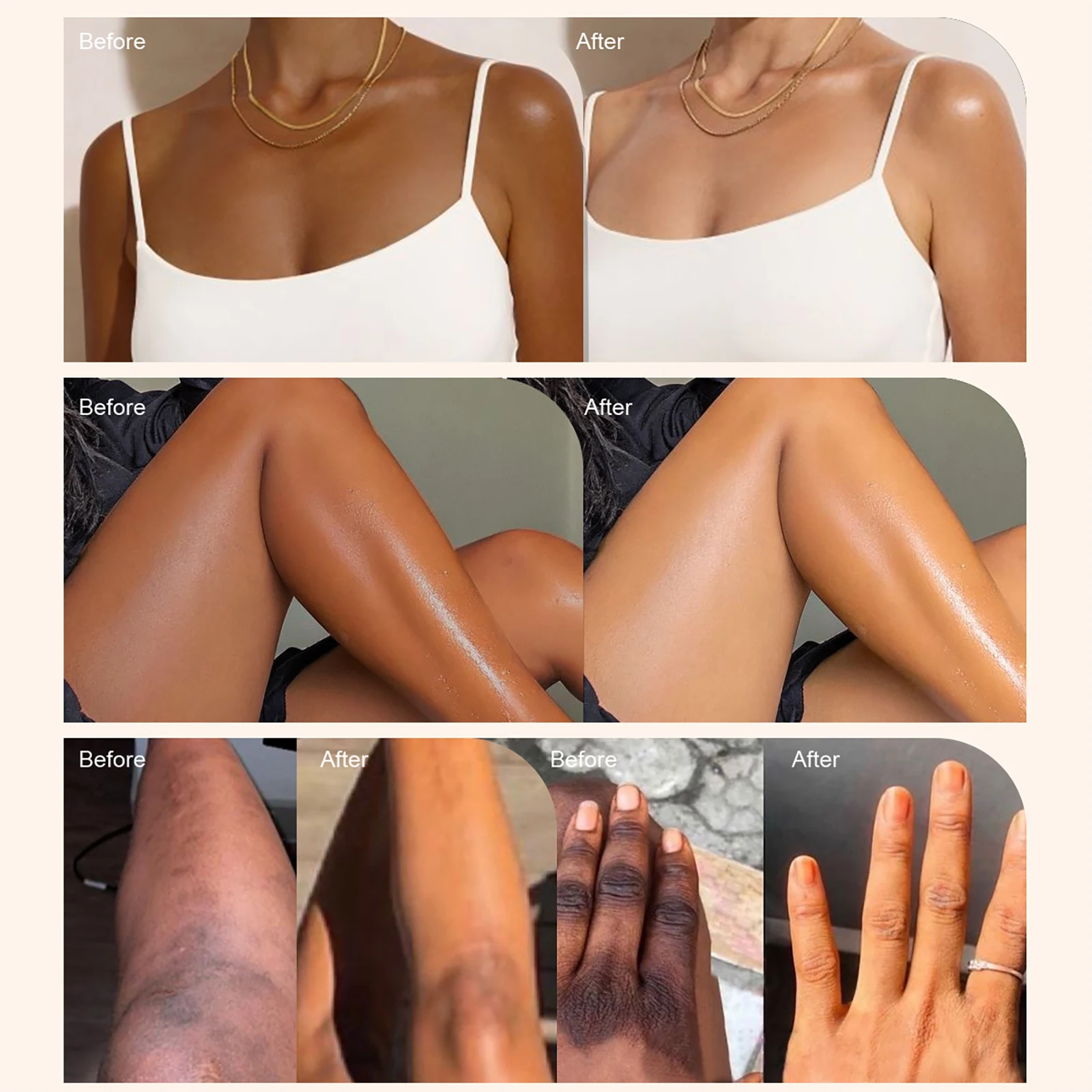 LKIAE Ultra Lightening Body Lotion, Reduce Spots, Melanin, With Collagen, Glutathione, - Image 5