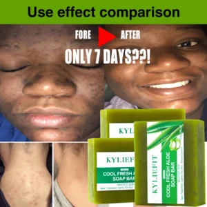 Aloe Brightening Soap Bar, Acne, Oil Control, Clean Stains, Exfoliation, For Face and Body, 200g