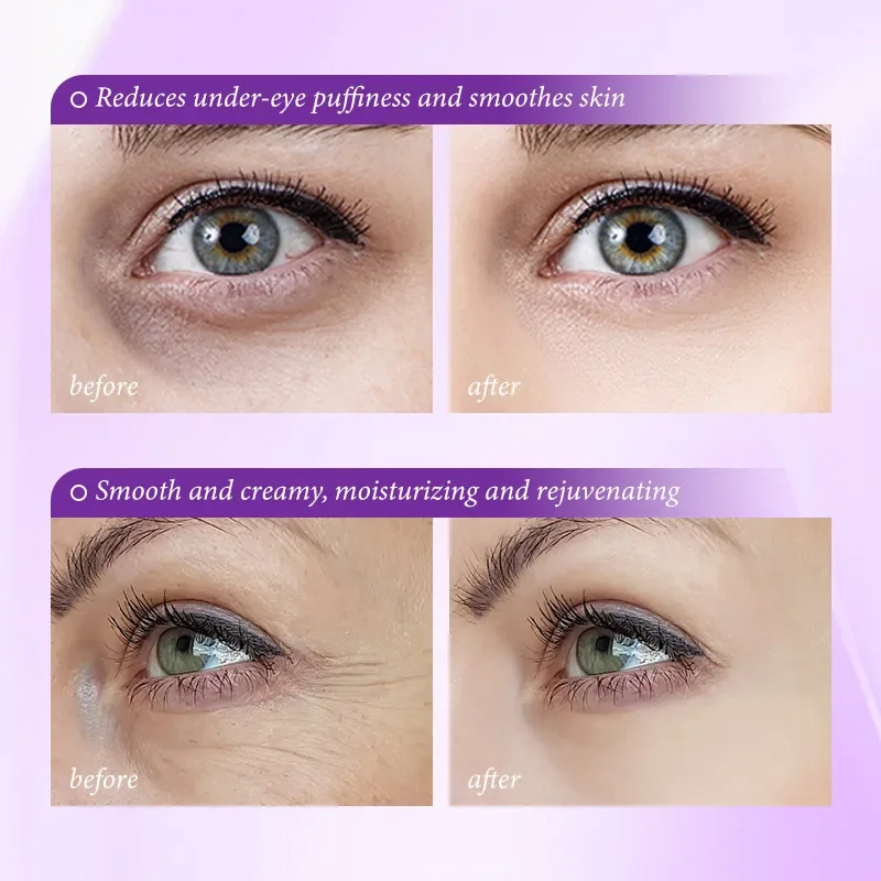 Instant Eye Bag Removal Cream Retinol Anti-Wrinkle Firming Skin Fade Fine Lines Anti Dark Circle Puffiness Brighten Eye skinCare - Image 2